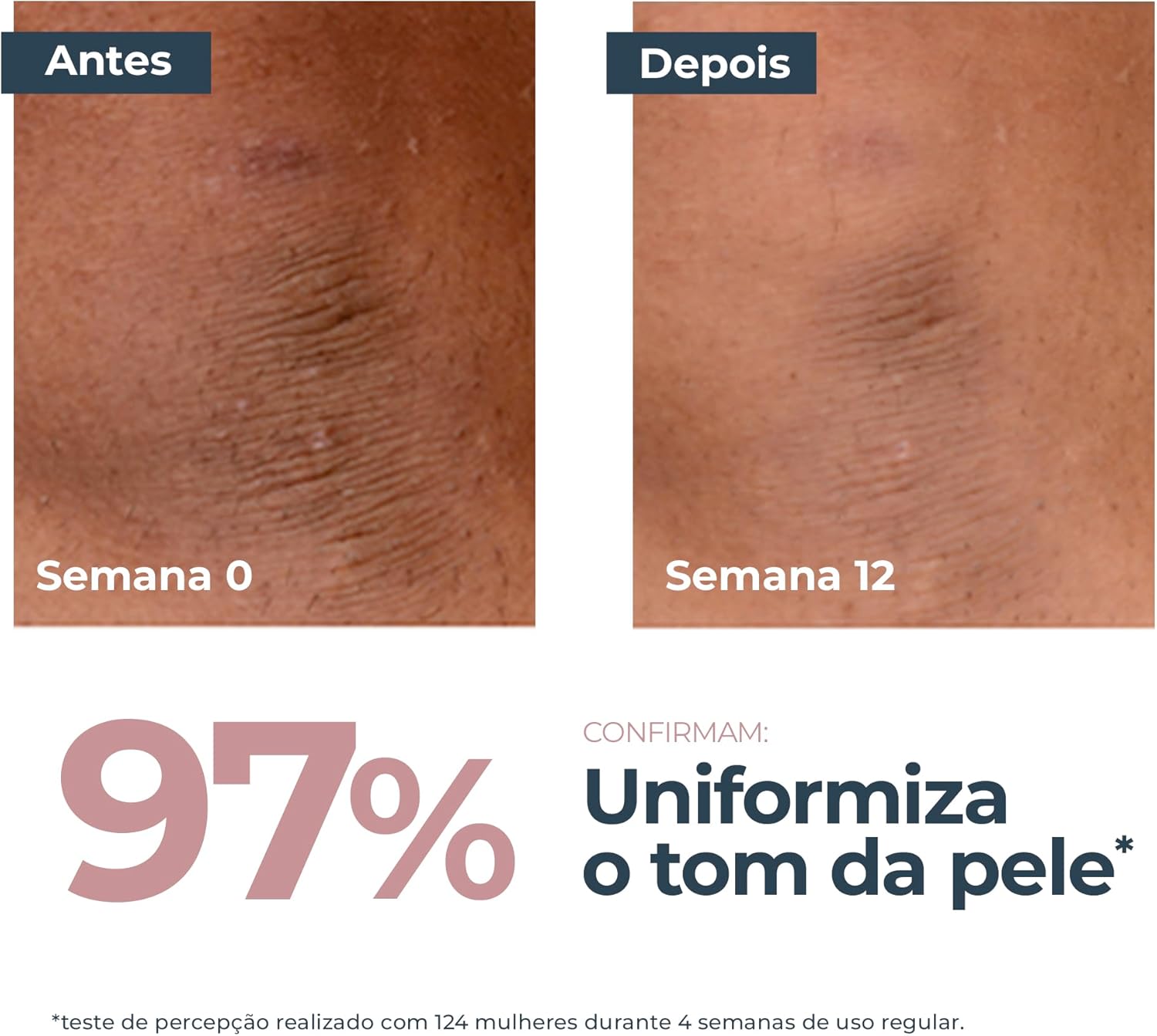 Creme Corporal Eucerin Anti-Pigment Antimanchas 200ml 4 Creme Corporal Eucerin Anti-Pigment Antimanchas 200ml - Imagem 4